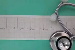 ECG Y HOLTER VETERINARIO ALTO VALLE