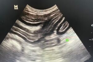 Ecografía veterinaria a domicilio. Dra. Laura Lopez